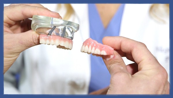Восстановление целостности зубного ряда